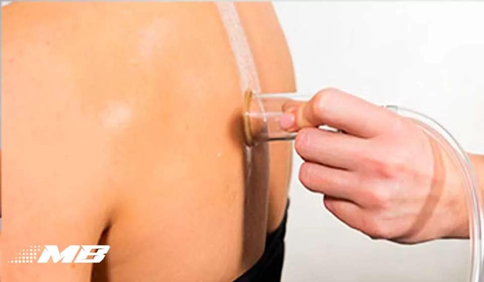 Physiotherapy
